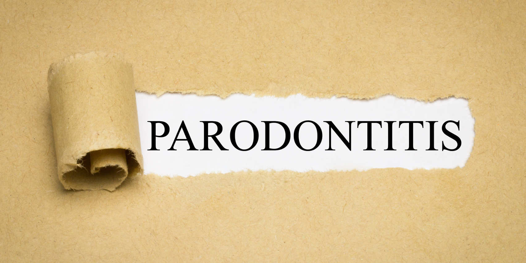 Alzheimer durch Parodontitis gefördert